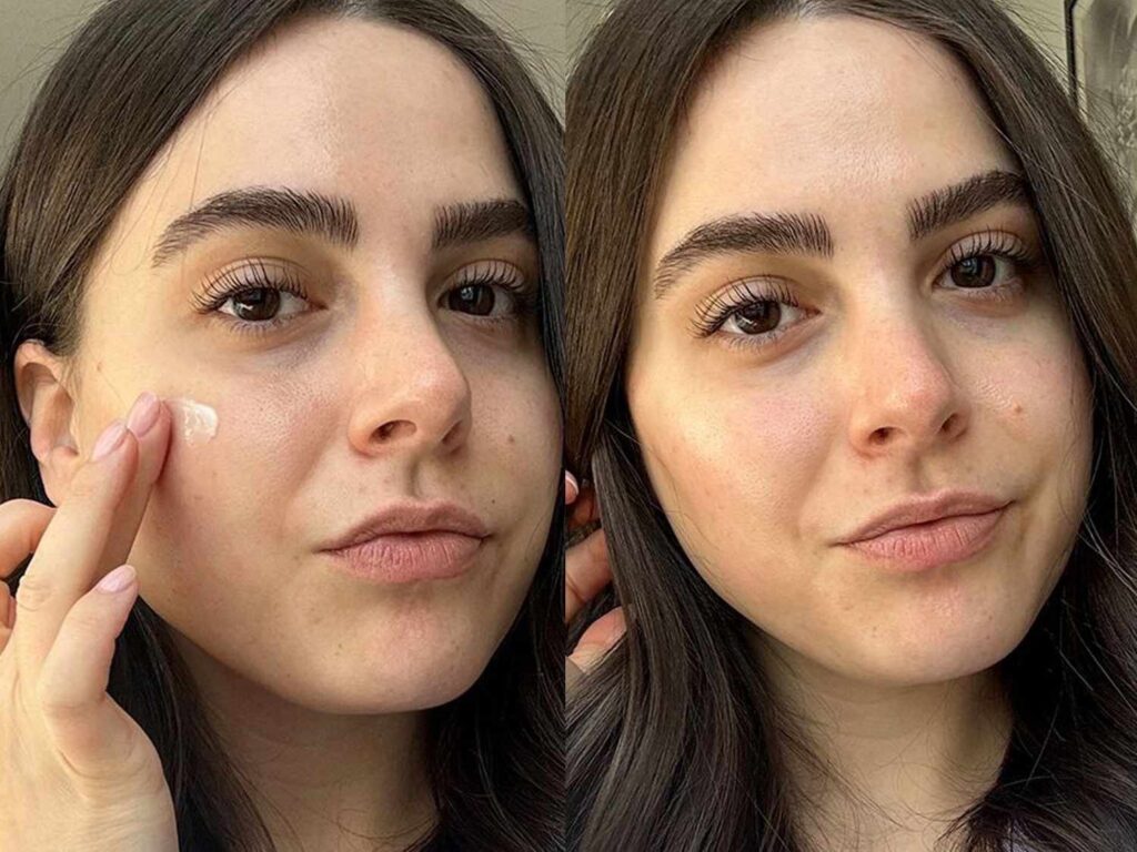 best moisturizer for dry skin